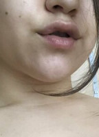 APOLLYMI_SG