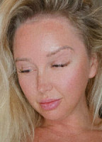 LACIDENISE