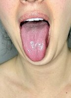 XXMISS.KXX