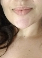 MIRELLASTARKFREE