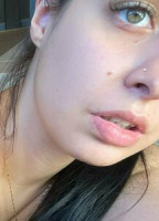 ZOEVIPXX
