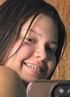 KIKISBRACES