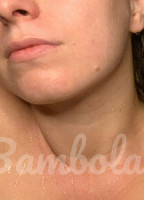 BAMBOLAFREE