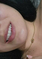 ALEXIAA18
