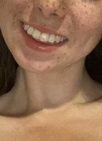 BABY ASH NUDE