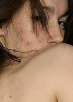 IISTARDUSTII NUDE