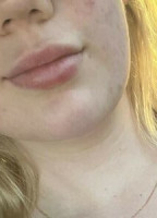 COSMETICNURSEX