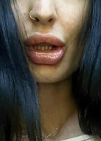 NASTYANNAX