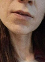 MISSMILANIS