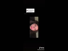 Bethany Jade Cat Scratch Lip Scar Storytime